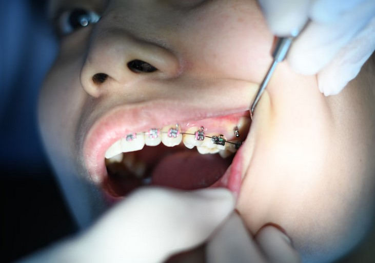 Langley sedation dentist'