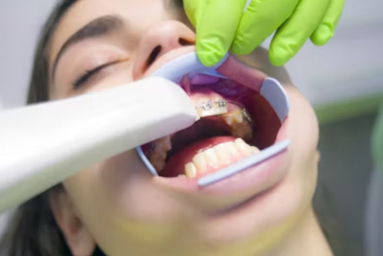 sedation dentistry in Virginia